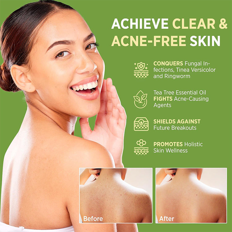 Sunora MIAOFUTONG Antifungal Soap